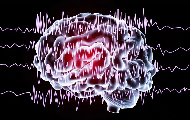 10 Mind-Opening Facts About Epilepsy Everyone Should Hear