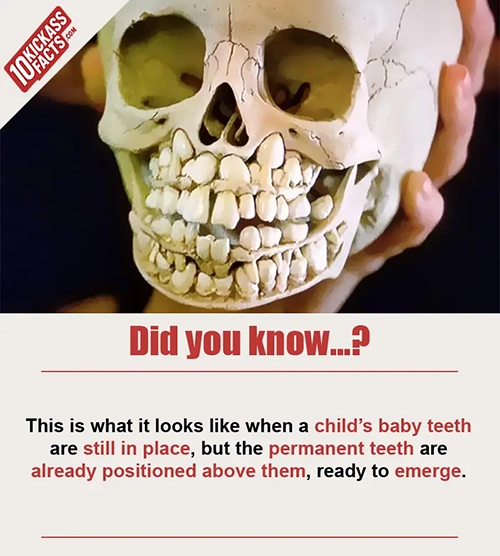 Random Picture Fact #44
