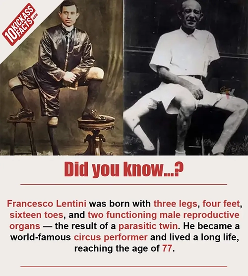 Random Picture Fact #9