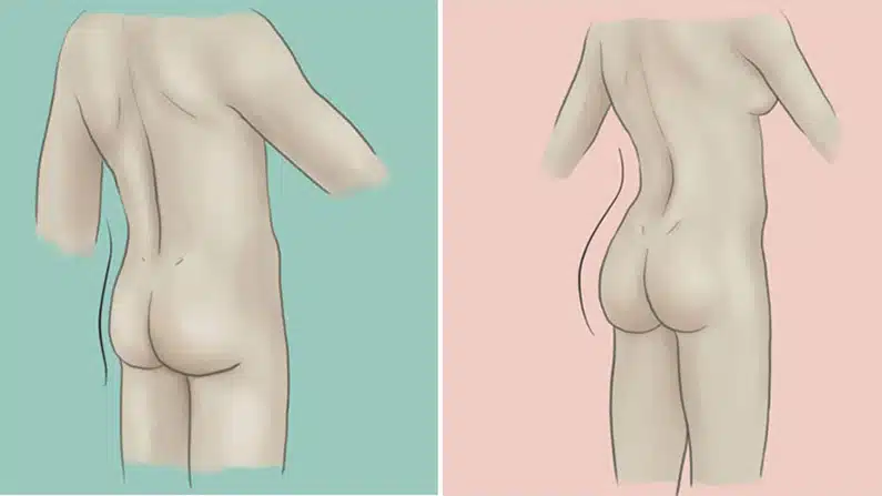 10 Weird and Wonderful Butt Facts